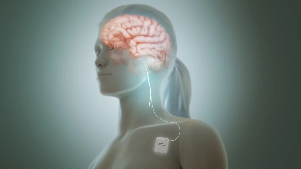 A Revolutionary Implant May Transform Depression Treatment