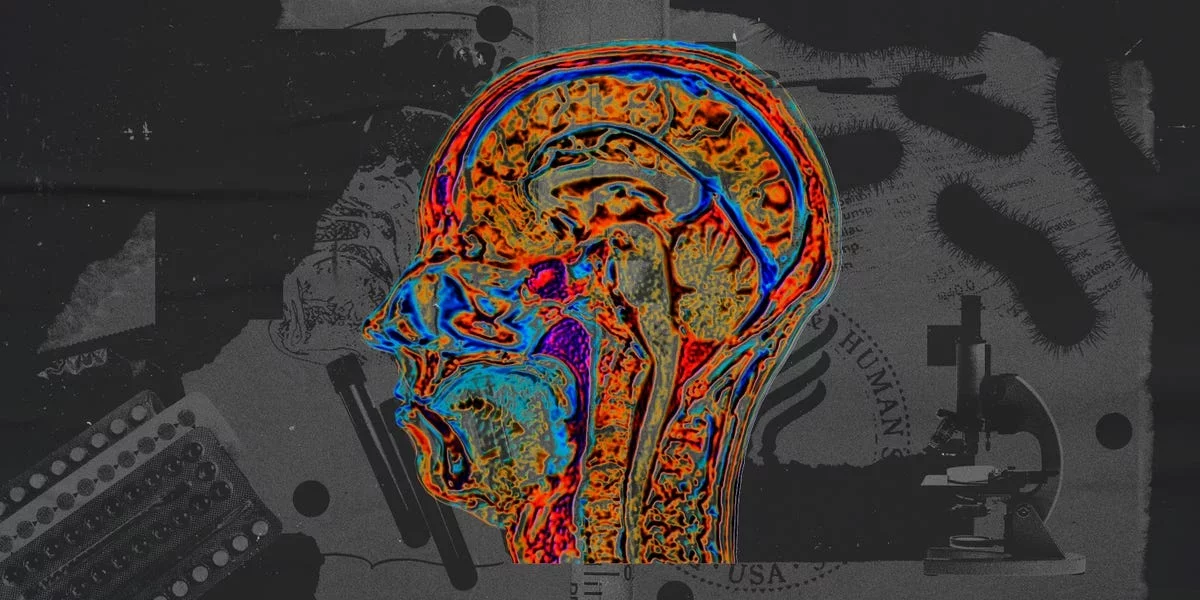 Integrating Alzheimer's Awareness into Chronic Disease Programs