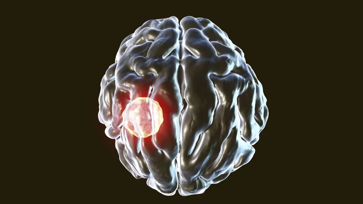 New Insights into the Immune Response Against Brain Parasite Toxoplasma gondii