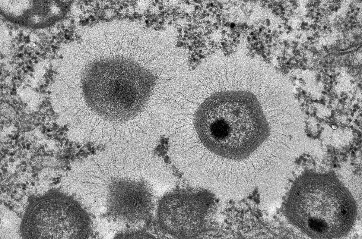 Giant Viruses Challenge the Definition of Life
