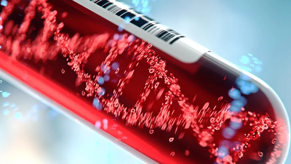 Revolutionary AI Blood Test Detects Silent Liver Disease Early