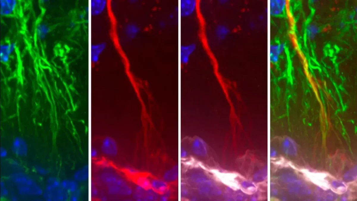 Breakthrough Discovery: Tanycytes May Combat Alzheimer's Tau Buildup