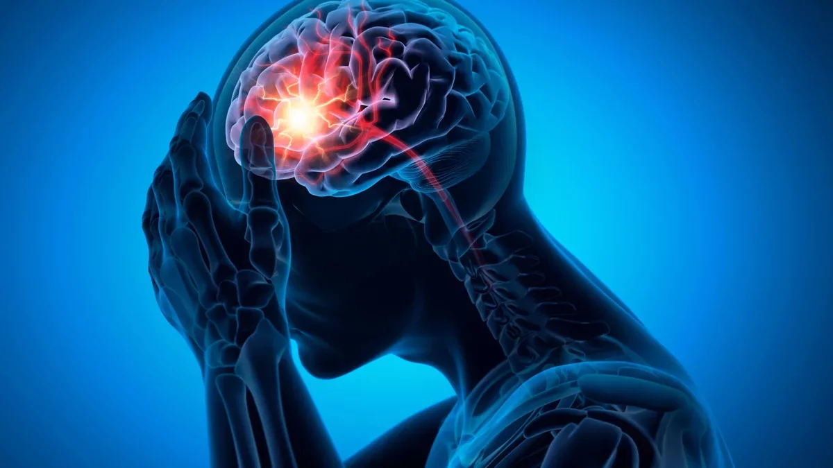 New Insights on Stroke Risks Linked to Common Dementia Medication