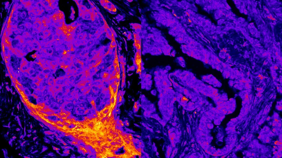 Revolutionary Discovery: Metabolism in the Cell Nucleus Unveiled