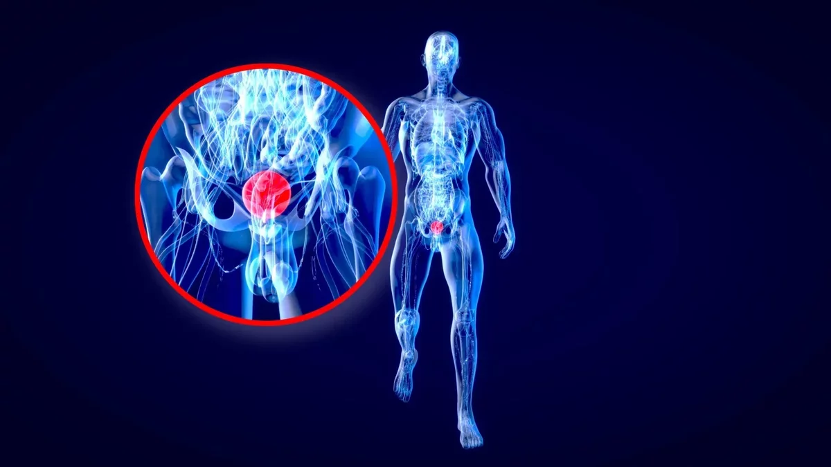 New Insights on Colorblindness and Bladder Cancer Survival Rates