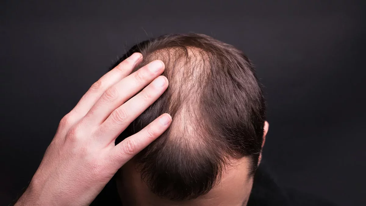Revolutionizing Our Understanding of Hair Growth: New Research Unveils Surprising Mechanisms