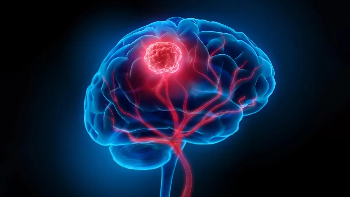 Innovative Virus Therapy Enhances Immune Response Against Brain Cancer