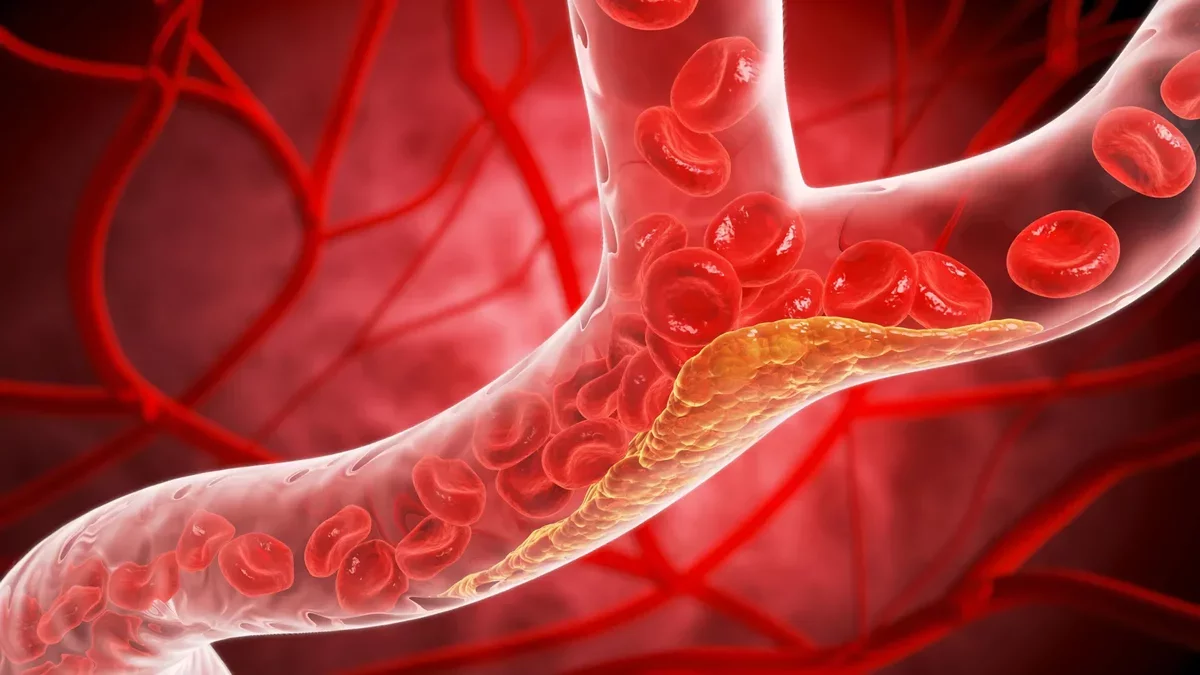 Revolutionary Oral Pill Reduces "Bad" Cholesterol by 60% in Landmark Study