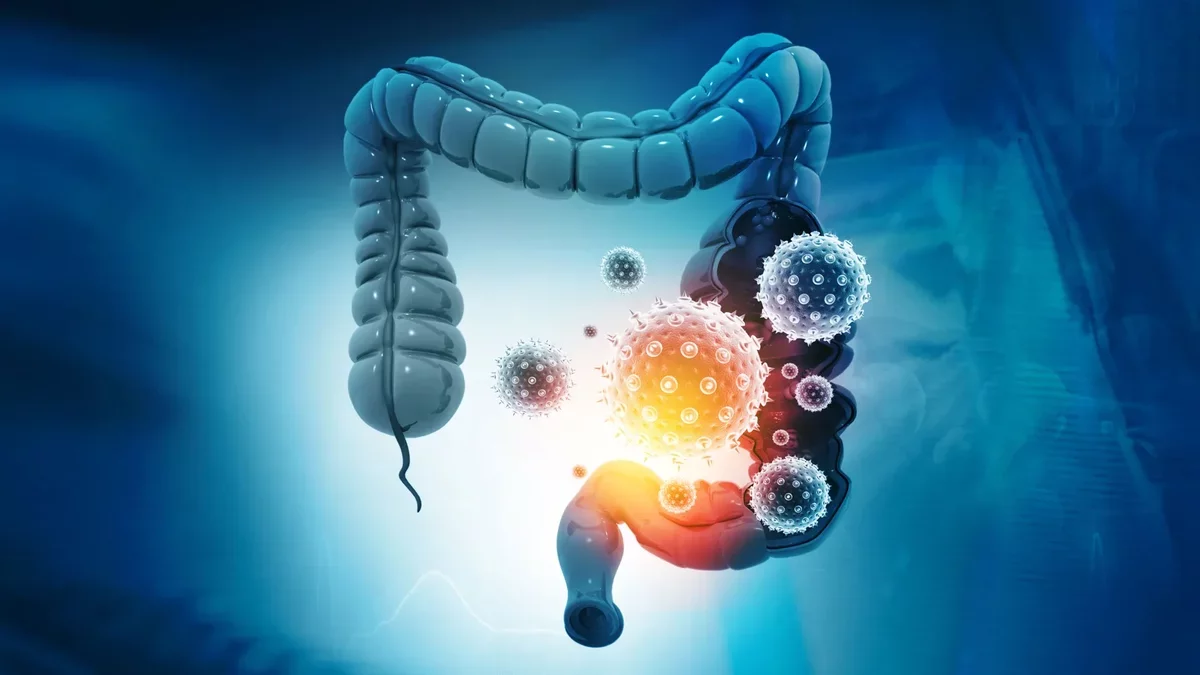 Revolutionary Insights into Colorectal Cancer Treatment