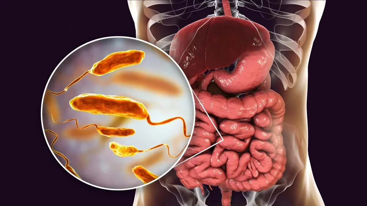 Dietary Changes Could Significantly Reduce Cholera Infections