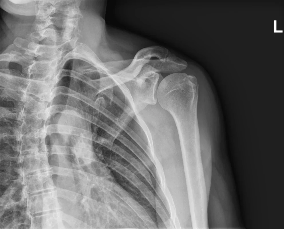 Rethinking AI's Role in Radiology: A Cautionary Perspective