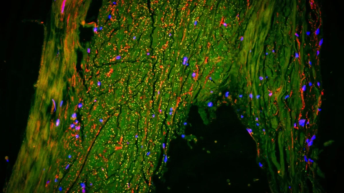 Breakthrough in Brain Research: Discovery of a Hidden Fluid Drainage System