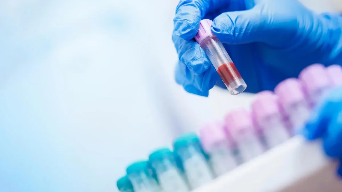 A Simple Blood Test May Predict Alzheimer's Risk Years in Advance