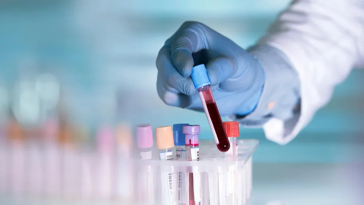 Revolutionary Blood Test Could Detect Depression Early