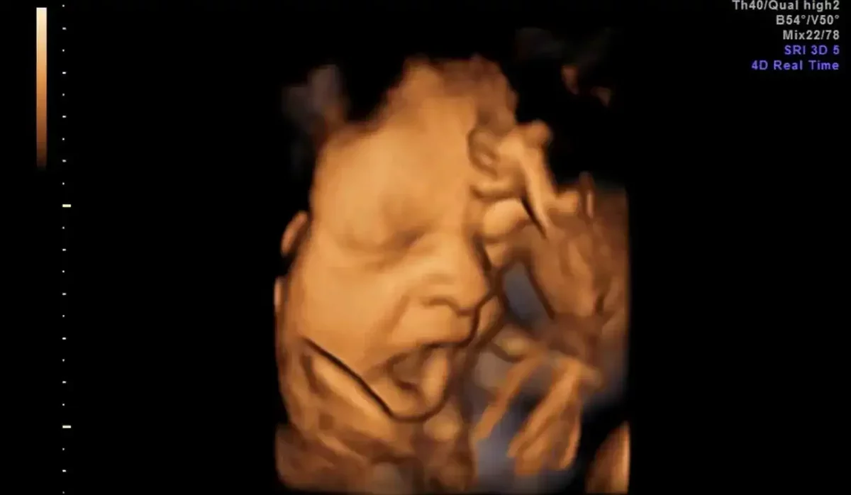 Fetuses Yawn in Sync with Mothers, Revealing a Deeper Connection