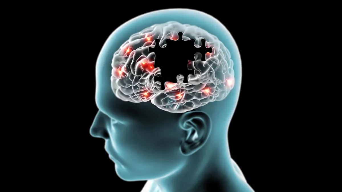 Speech Patterns May Indicate Early Dementia Risk