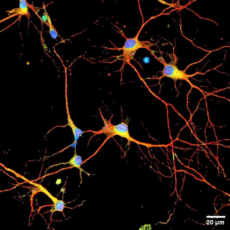 Breakthrough Alzheimer's Drug FLAV-27 Shows Promise in Reversing Memory Decline in Mice