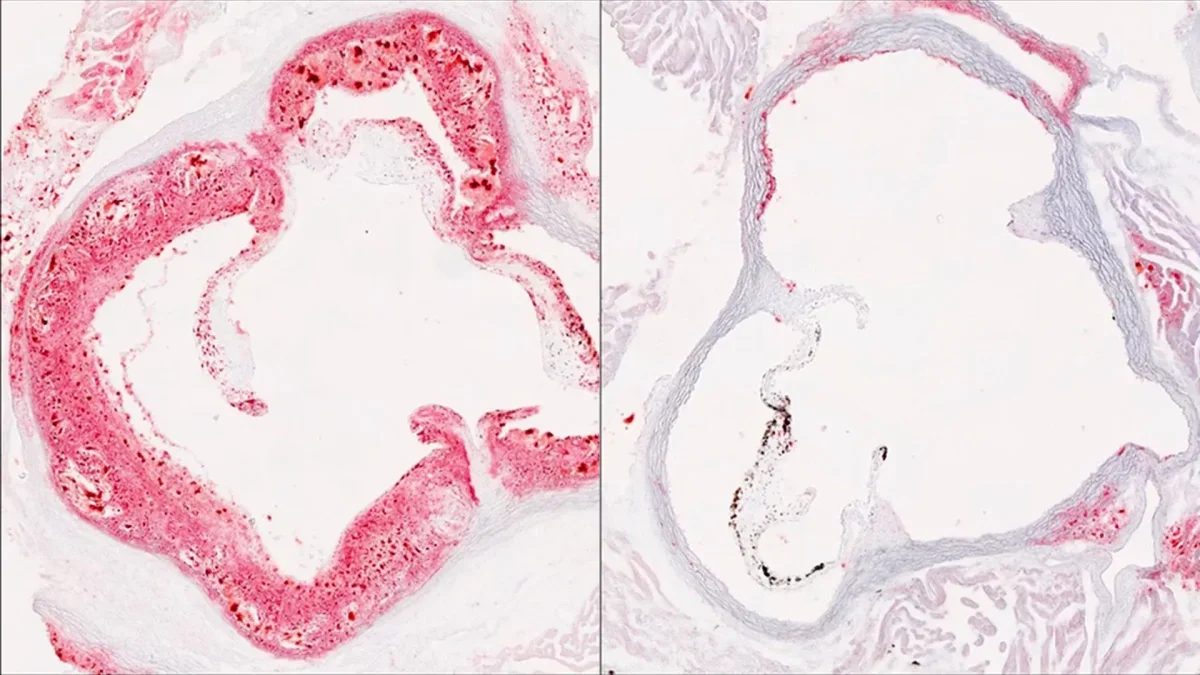 Breakthrough in Cholesterol Control: Scientists Identify Key Liver Protein