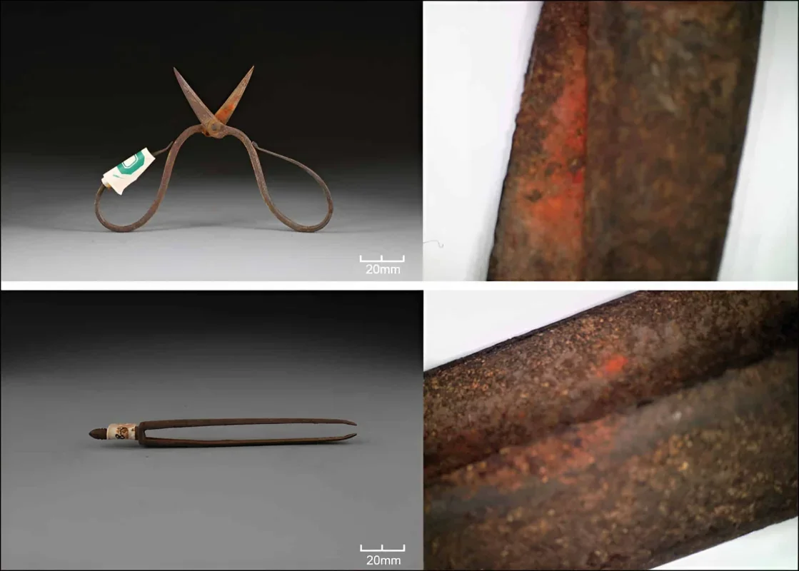 Ancient Surgical Instruments in China Reveal Early Use of Anesthesia