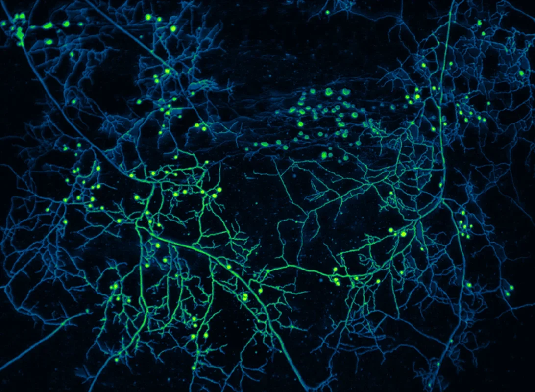 Earth's Underground Fungal Networks Map Reveals a Vast Hidden Ecosystem