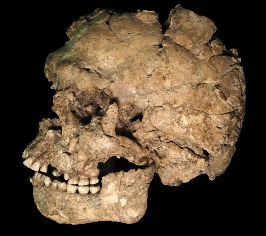 100,000-Year-Old Jaw Injury Reveals an Early Human Survivor