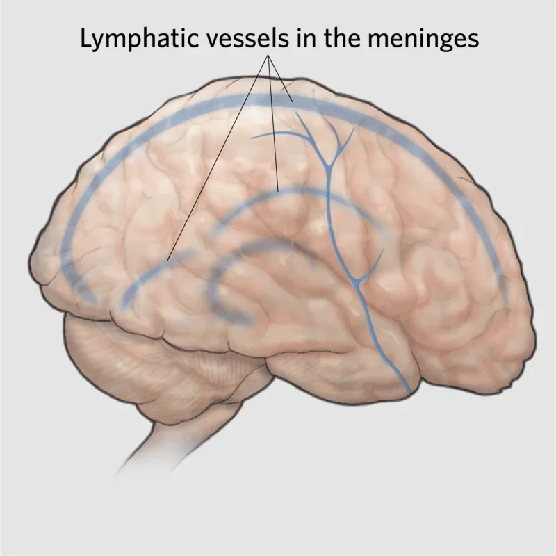 Chronic Fatigue Syndrome May Affect the Brain's Waste-Clearing System