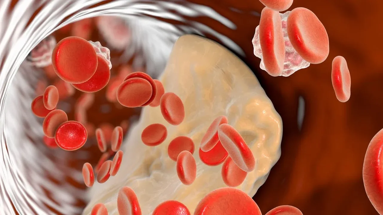 ApoB Test May Offer a Sharper View of Cholesterol Risk