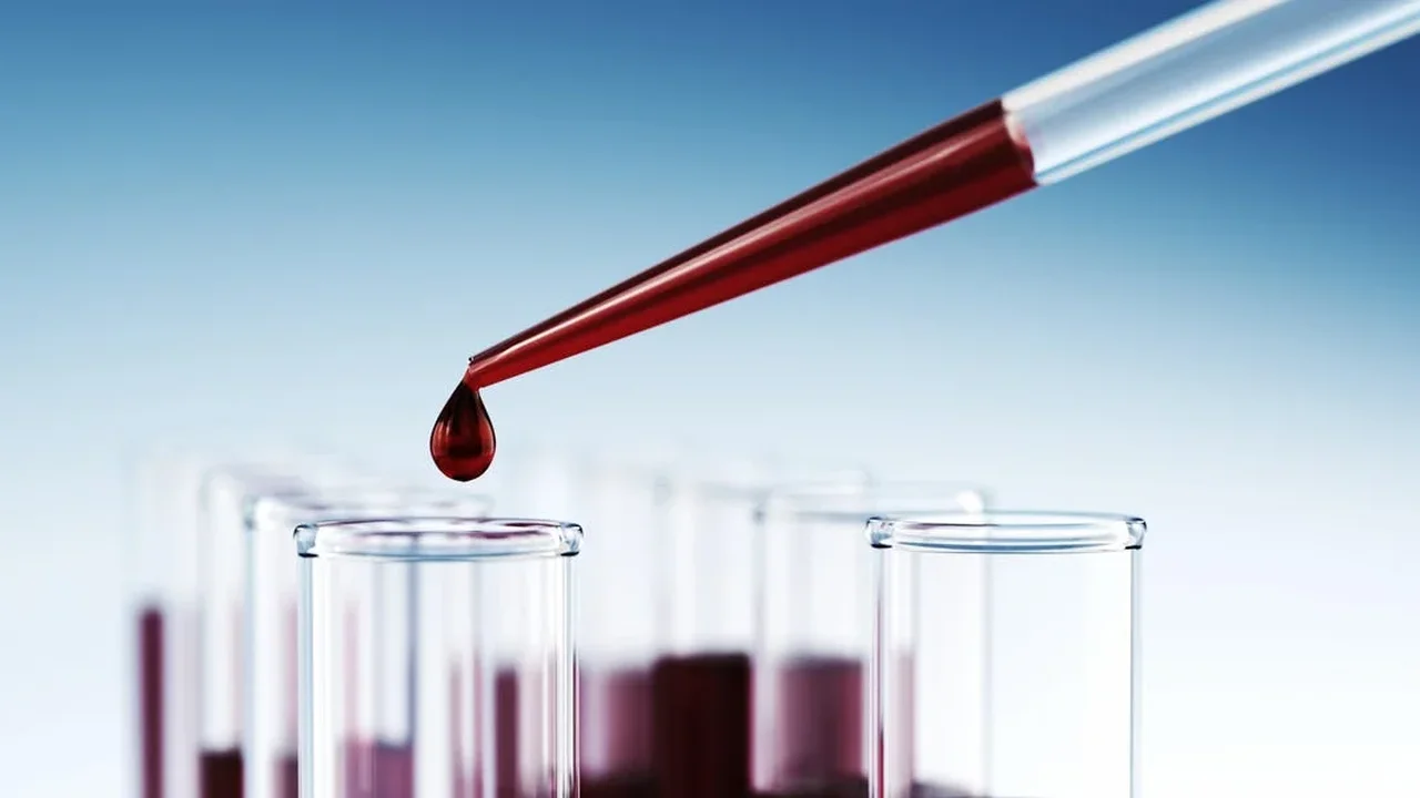 A Urologist Explains When Testosterone Testing Really Matters