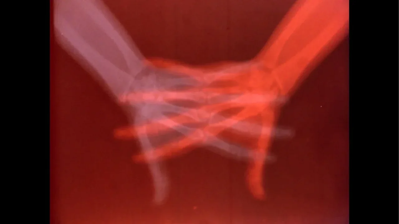 "Overexposed" Explores the Artistic Legacy of Medical Imaging