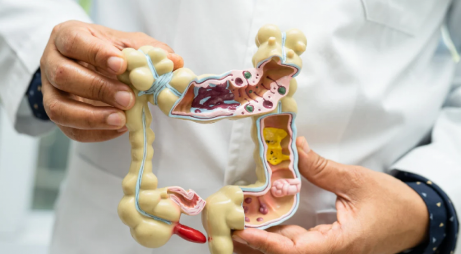 Kolon Kanseri Belirtileri ve Hastalıktan Korunma Yolları